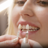 dientes2